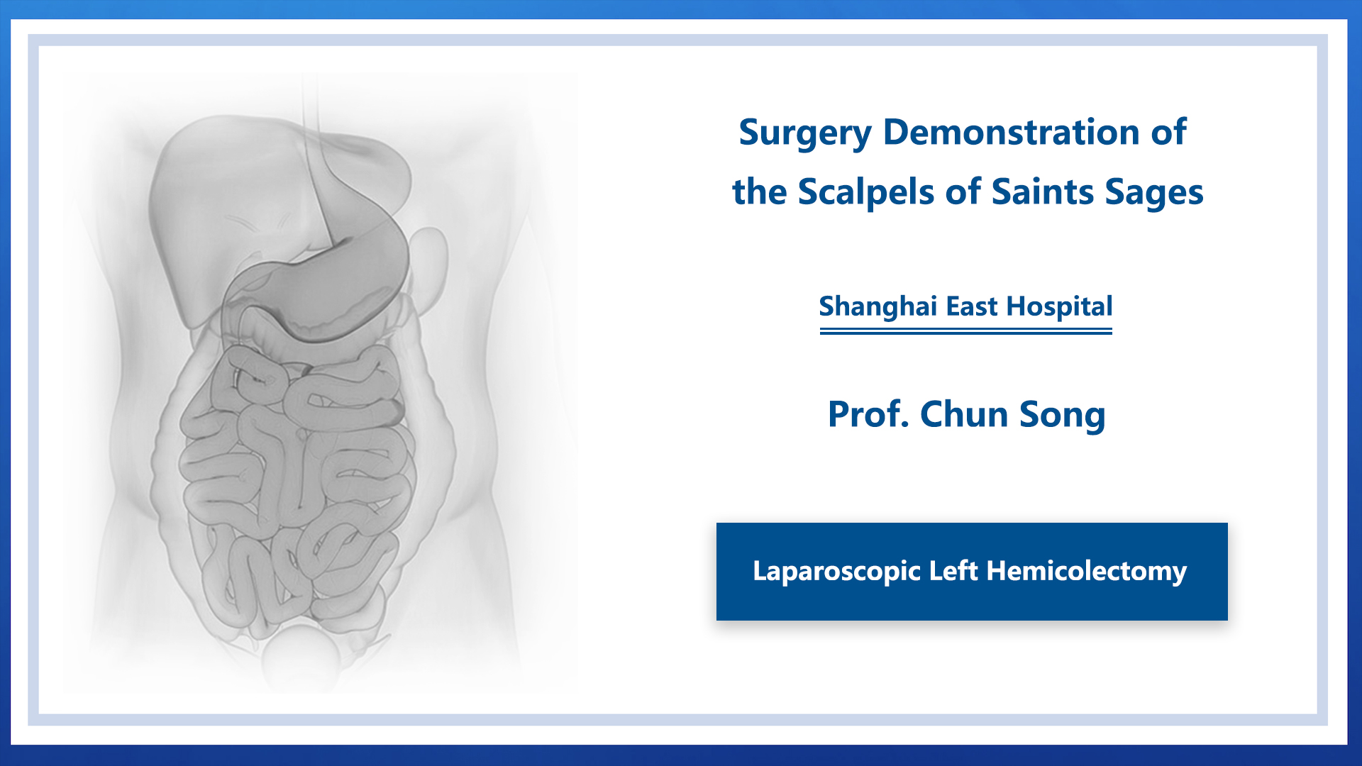 Laparoscopic Left Hemicolectomy