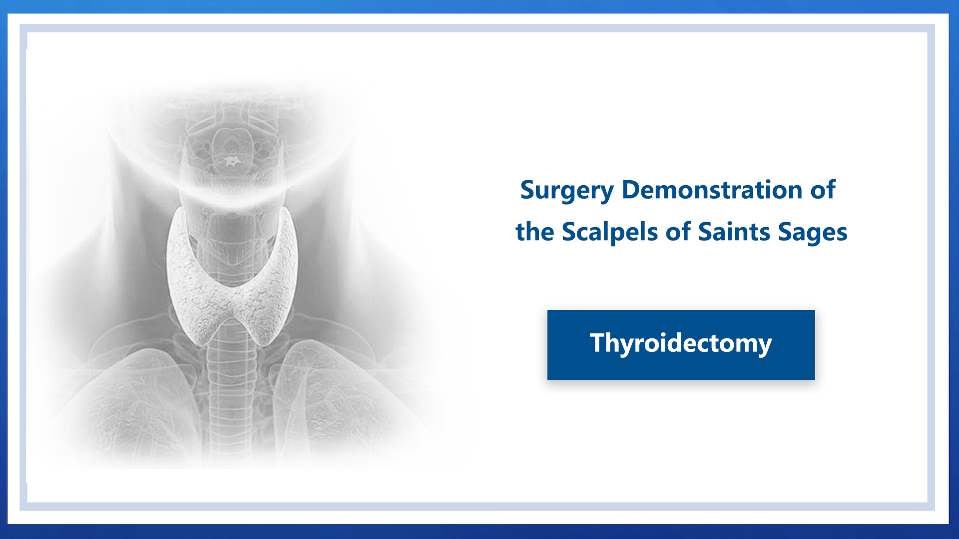 Thyroidectomy