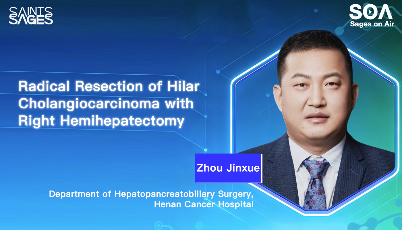Radical resection of hilar cholangiocarcinoma combined with right hemihepatectomy