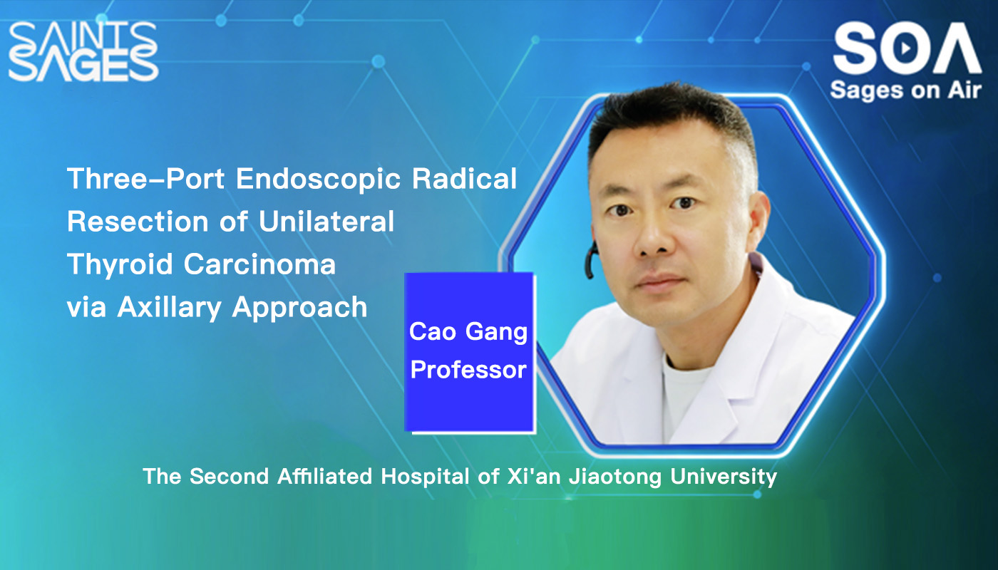 Three-port endoscopic radical resection of unilateral thyroid carcinoma via axillary approach