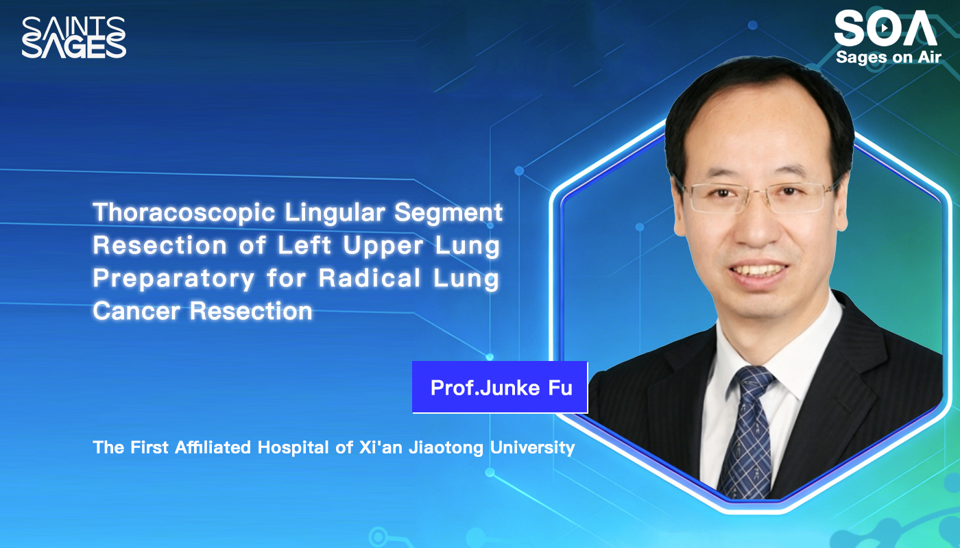 Thoracoscopic Lingular Segment Resection of Left Upper Lung Preparatory for Radical Lung Cancer Resection