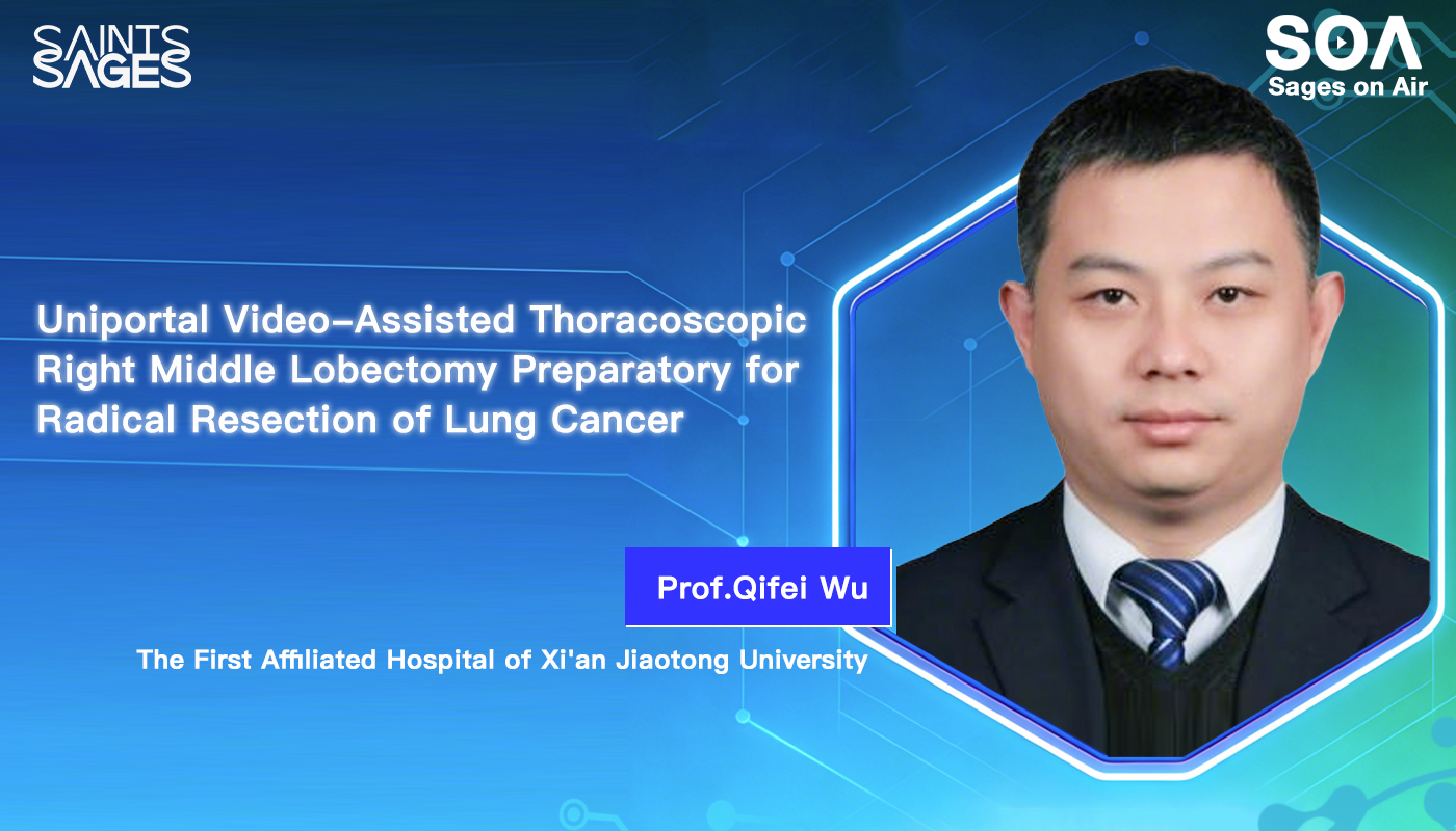 Uniportal Video-Assisted Thoracoscopic Right Middle Lobectomy Preparatory for Radical Resection of Lung Cancer